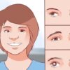 نیستاگموس چیست؟